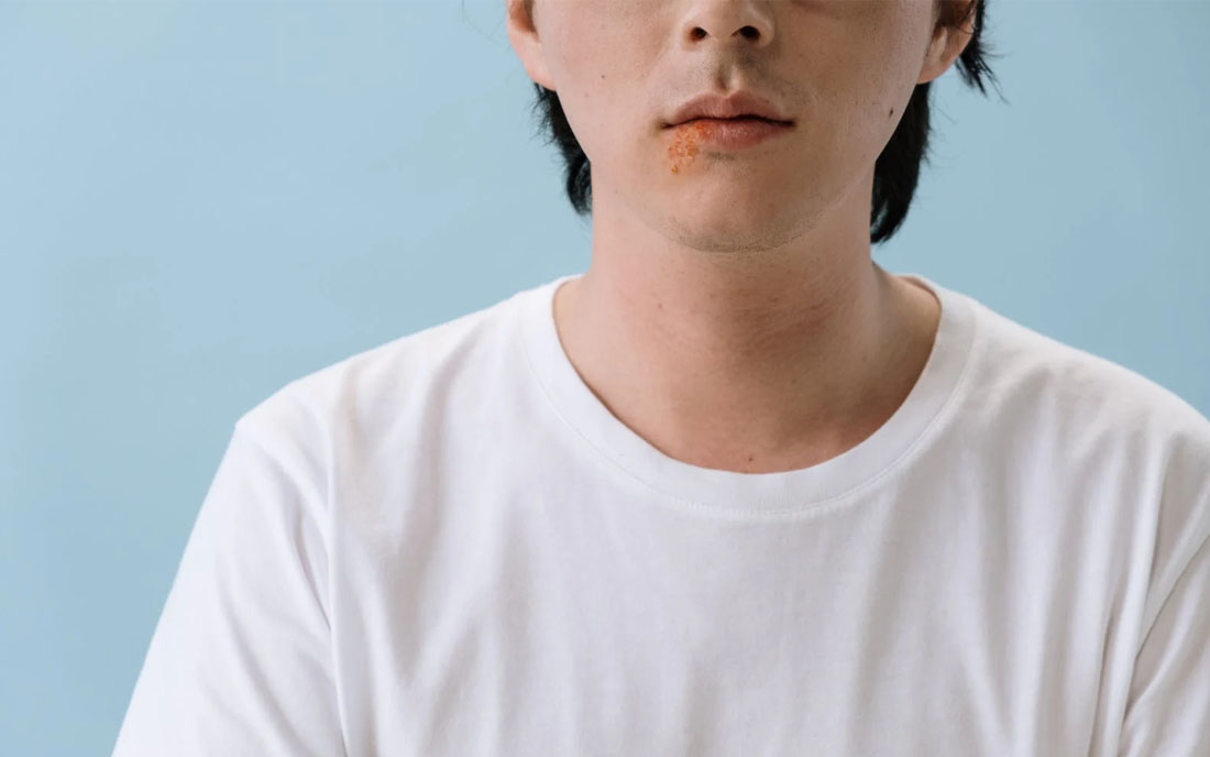 Skóra problematyczna